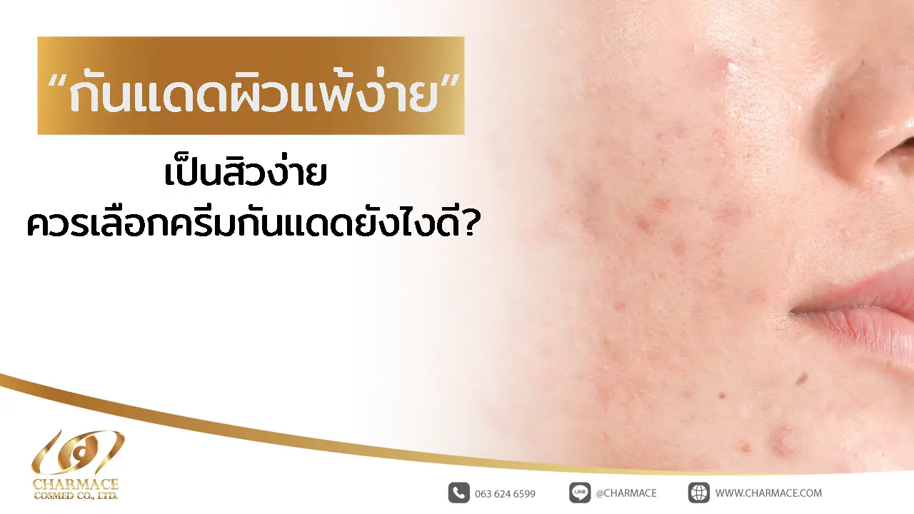 กันแดดผิวแพ้ง่าย เป็นสิว ง่าย ควรเลือกครีมกันแดดยังไงดี?